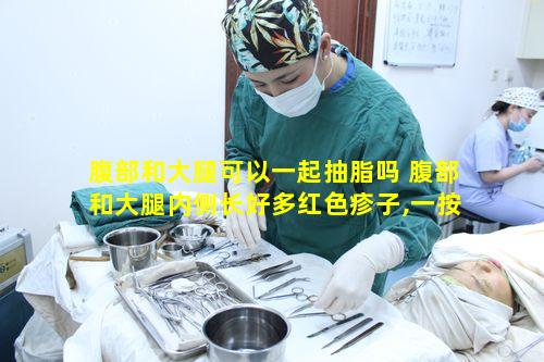 腹部和大腿可以一起抽脂吗 腹部和大腿内侧长好多红色疹子,一按有点疼,但是不痒